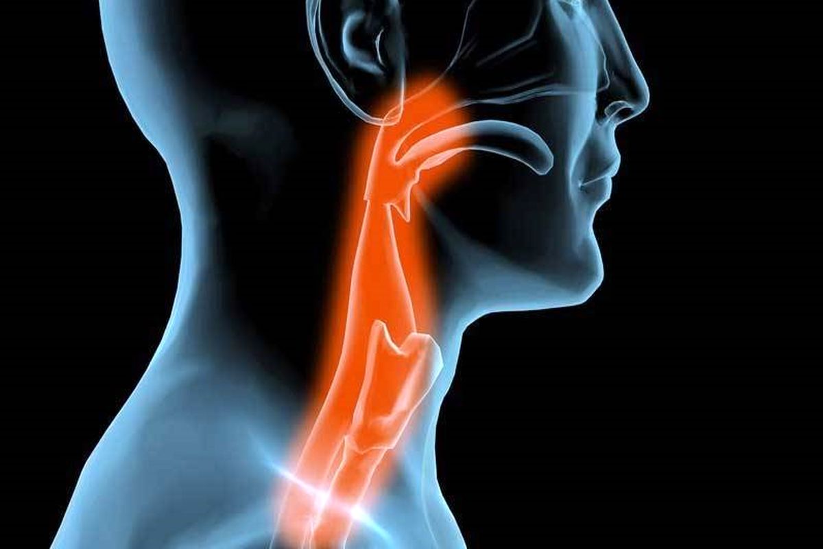 روش های تشخیص اختلالات بلع